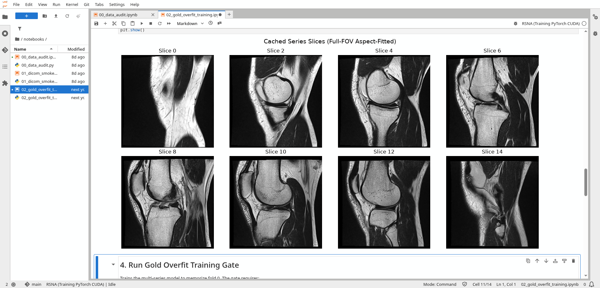 Jupyter notebook output of 8 knee MRI sagittal slices aspect-fitted